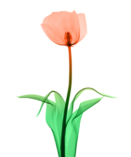 Mammogram (A) Color Awards Winners and Nominees