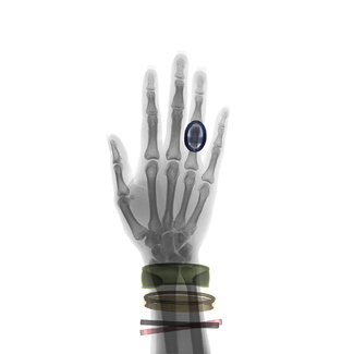 Hand and Bracelets Color Awards Winners and Nominees